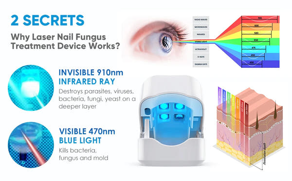 VELCURA™ Nail Fungus Laser Treatment Device