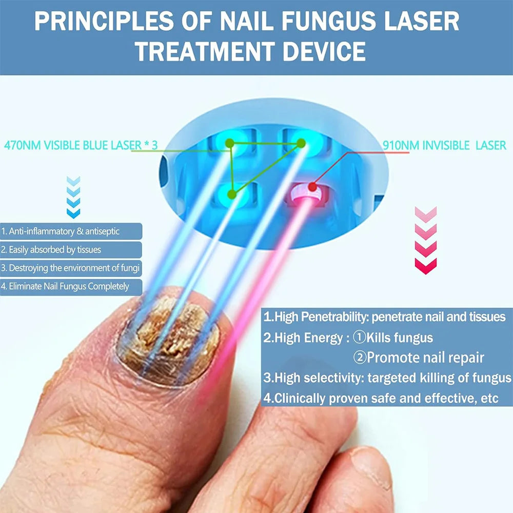 VELCURA™ Nail Fungus Laser Treatment Device