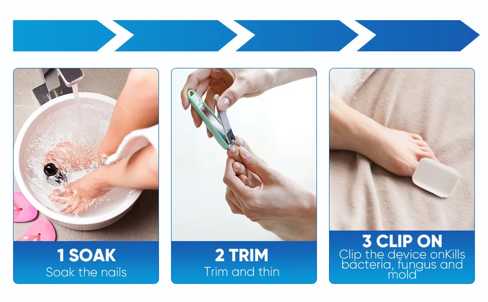 VELCURA™ Nail Fungus Laser Treatment Device