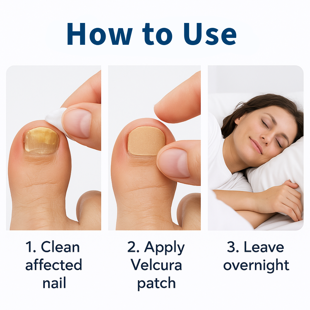 VELCURA™ Fungal Nail Patches