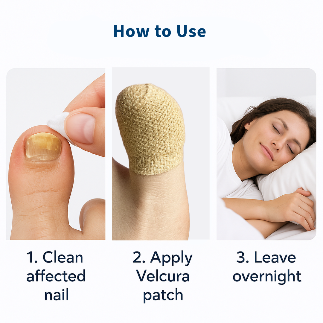 VELCURA™ Fungal Nail Patches
