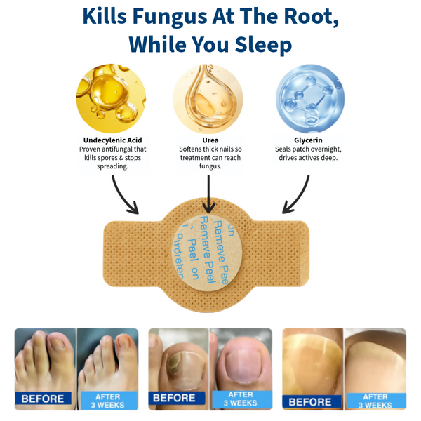 VELCURA™ Fungal Nail Patches
