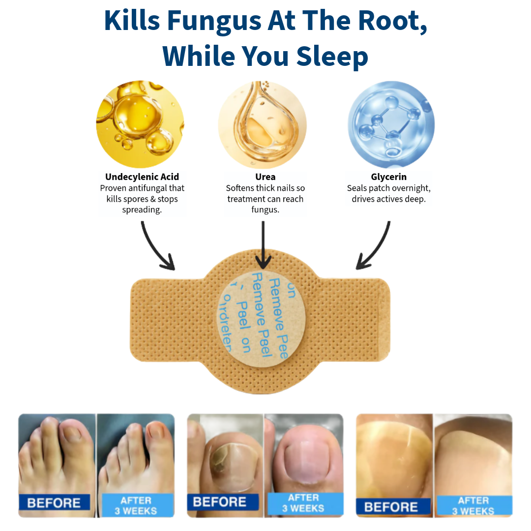 VELCURA™ Fungal Nail Patches
