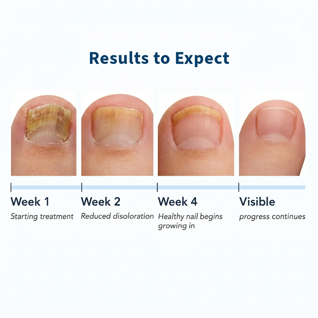 VELCURA™ Fungal Nail Serum VELCURA