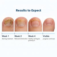 VELCURA™ Fungal Nail Patches
