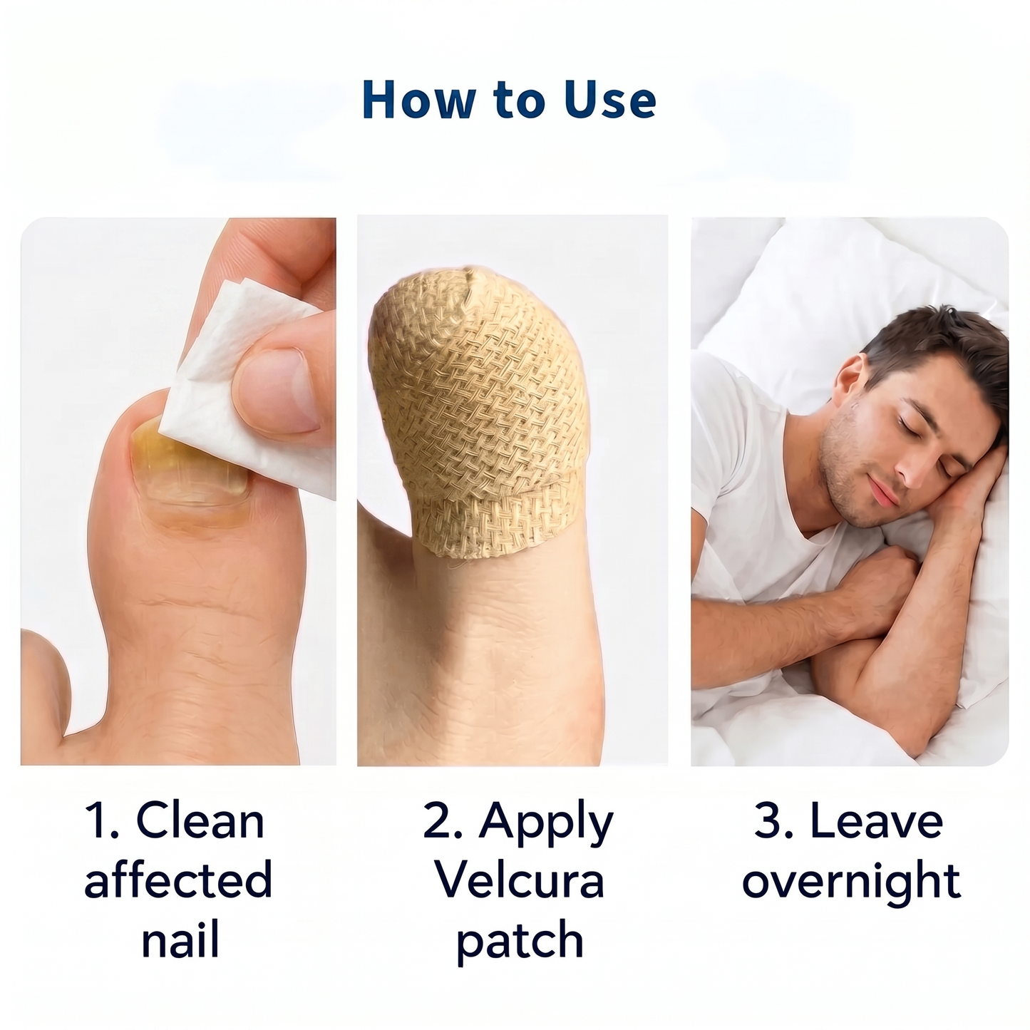 VELCURA™ Fungal Nail Patches