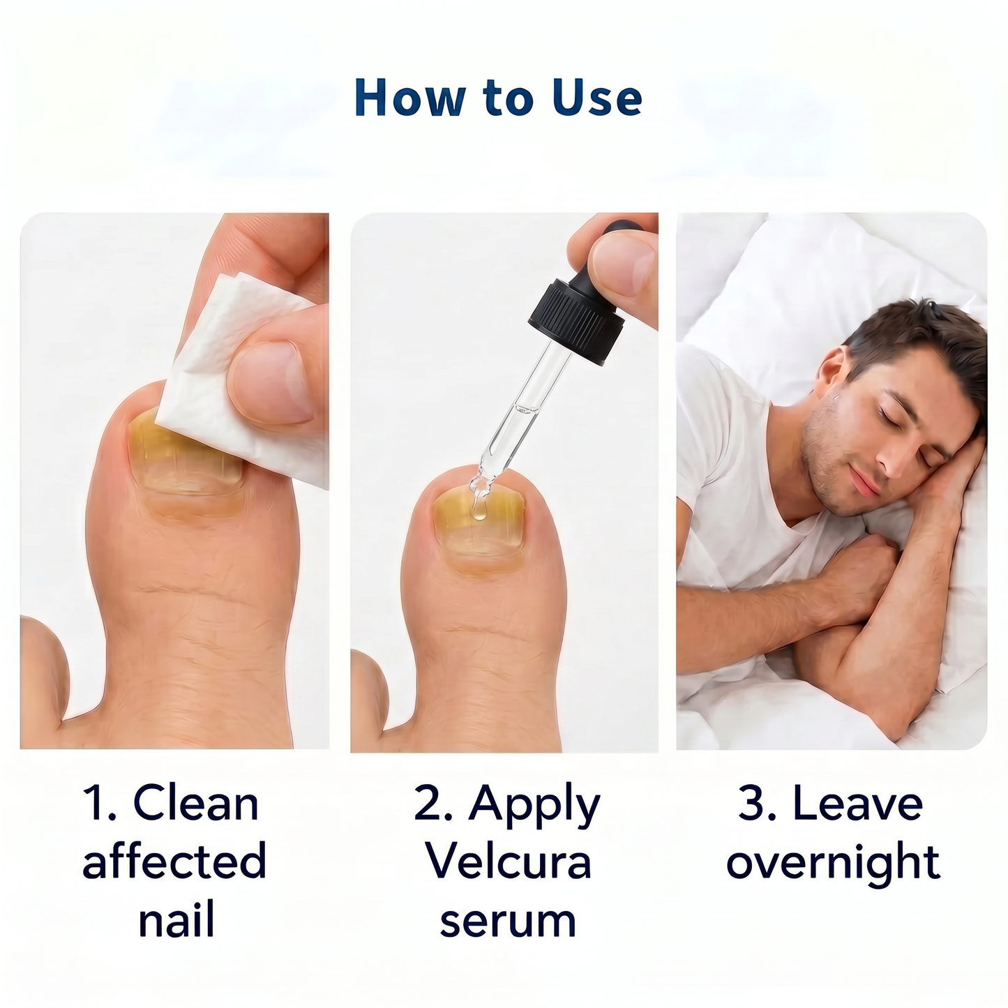 VELCURA™ Fungal Nail Serum